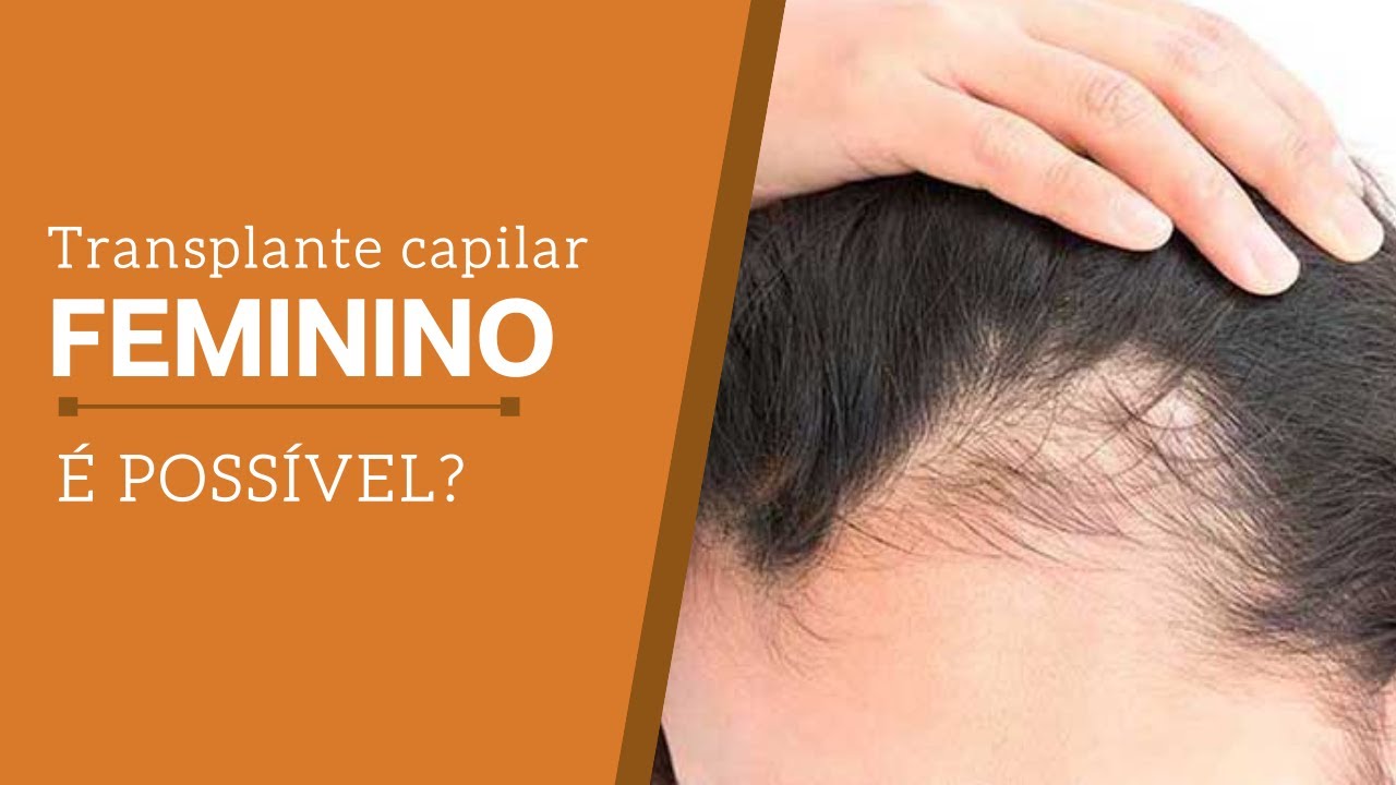 Transplante capilar na mulher/feminino