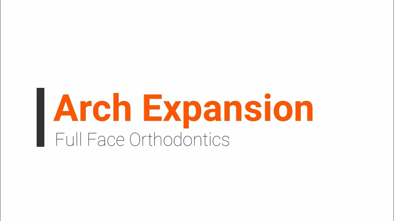 Arch Expansion