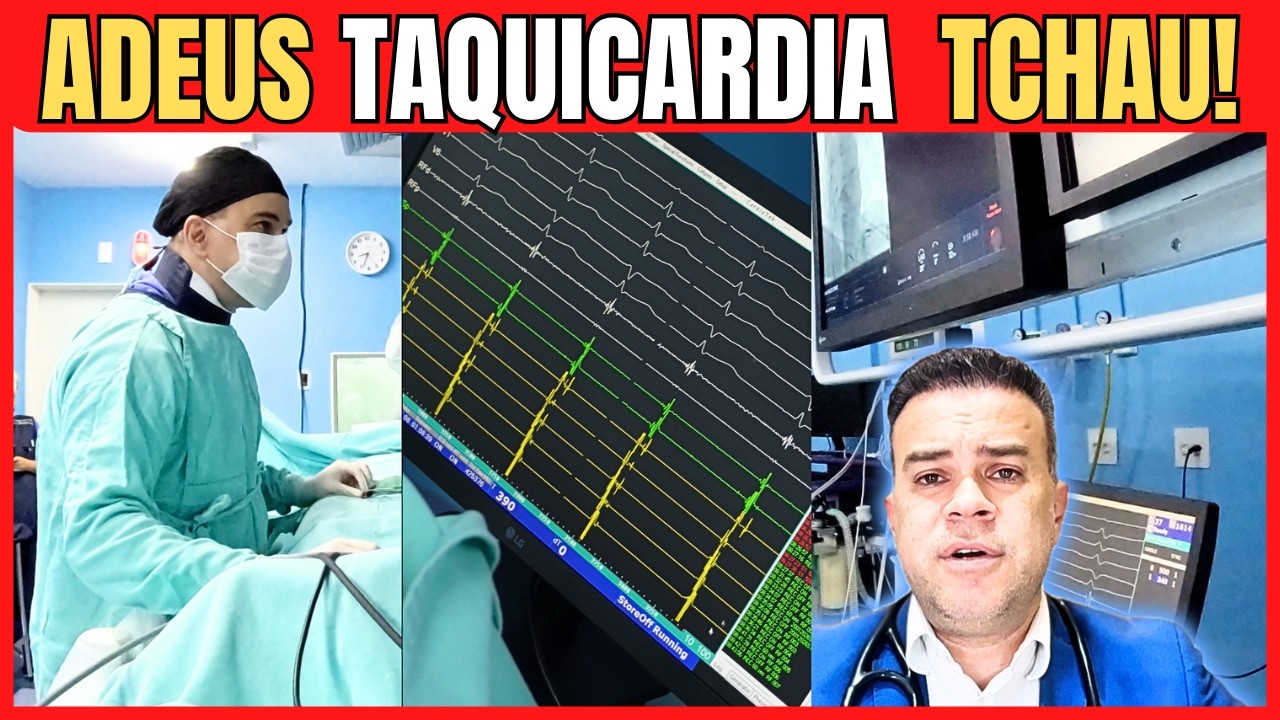 ABLAÇÃO DE TAQUICARDIA SUPRAVENTRICULAR - tudo por causa de um fiozinho a mais dentro do coração