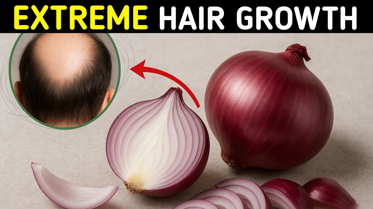 Onion Juice For Extreme Hair Growth: Stop Hair Fall