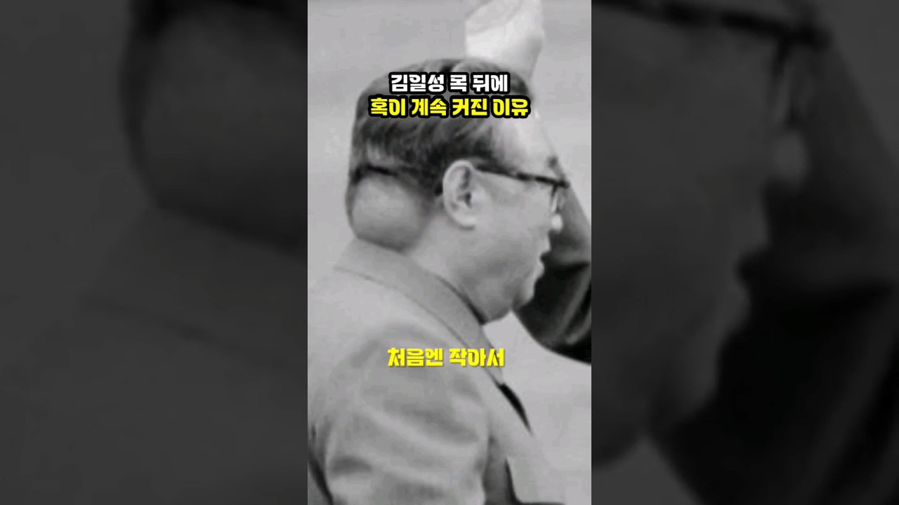 김일성이 혹부리 영감이 된 진짜 이유 ㅎㄷㄷ