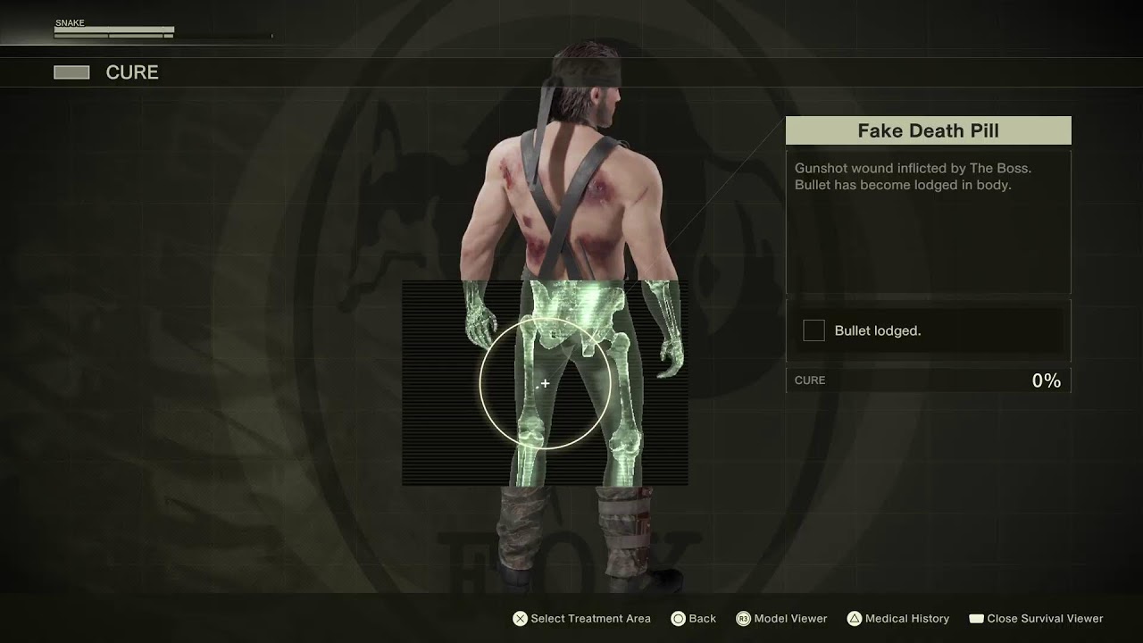 Mgs