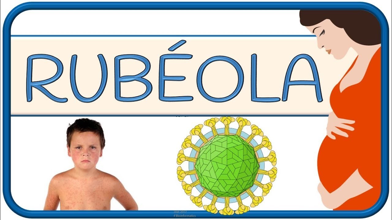 RUBÉOLA – fisiopatología, congénita, posnatal, síntomas, diagnóstico, tratamiento y prevención