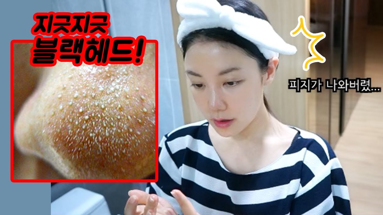 ENG) 유나가 하는 블랙헤드 케어법 Blackhead care routine | 뷰티클라우드 유나 UNA