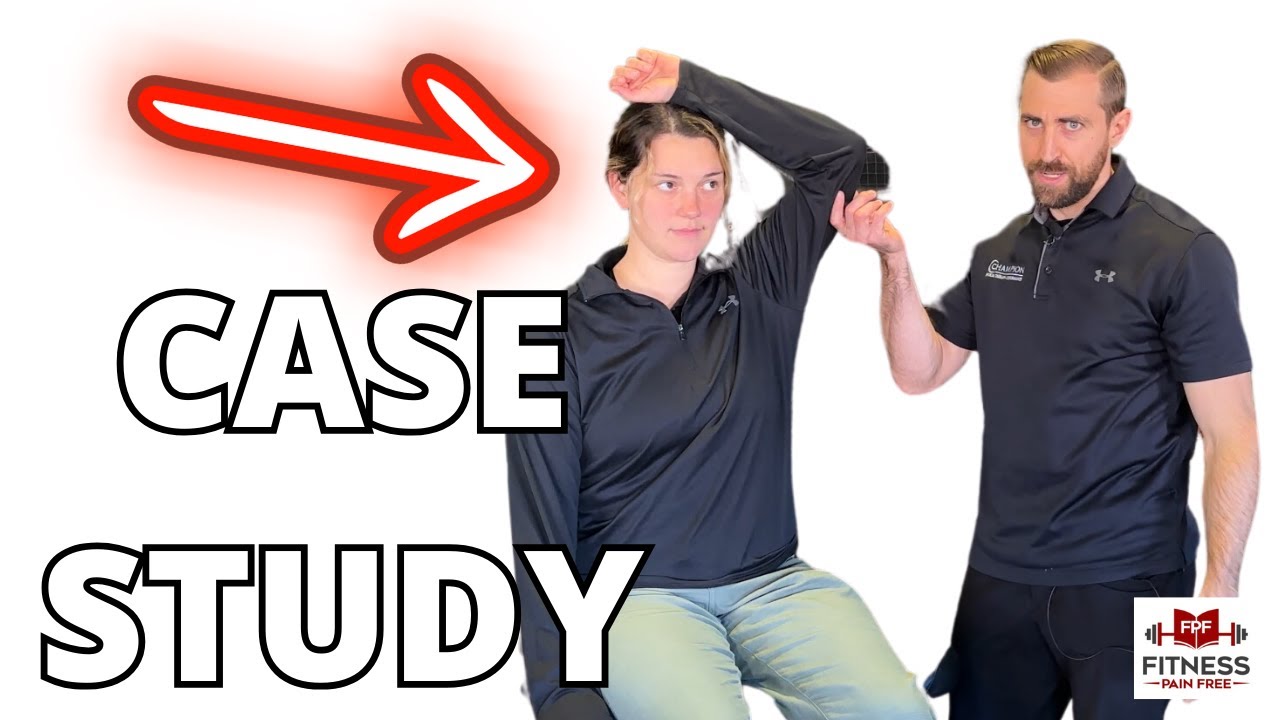 How I Diagnose and Treat Cervical Radiculopathy [CASE STUDY Physical Therapy]