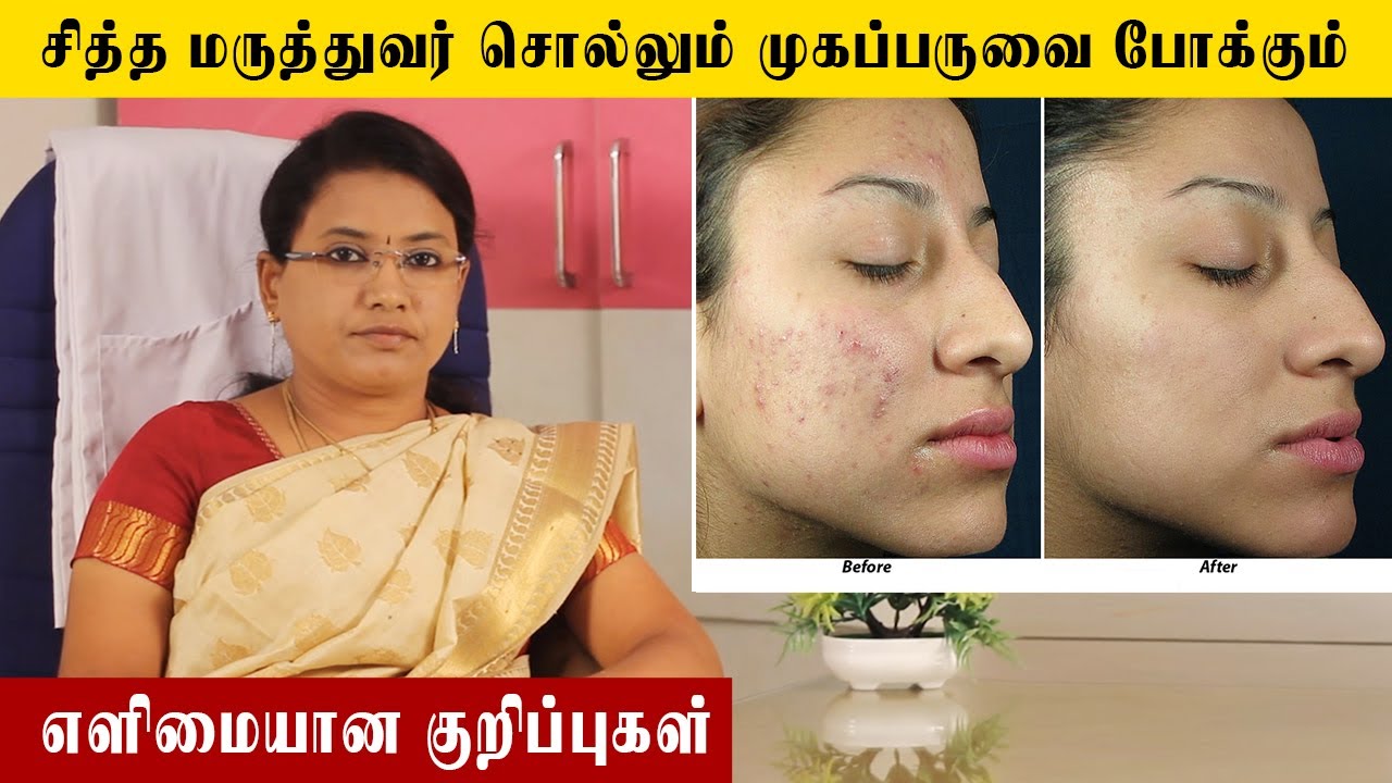 Siddha Treatment for pimples and acne | Samayam Tamil
