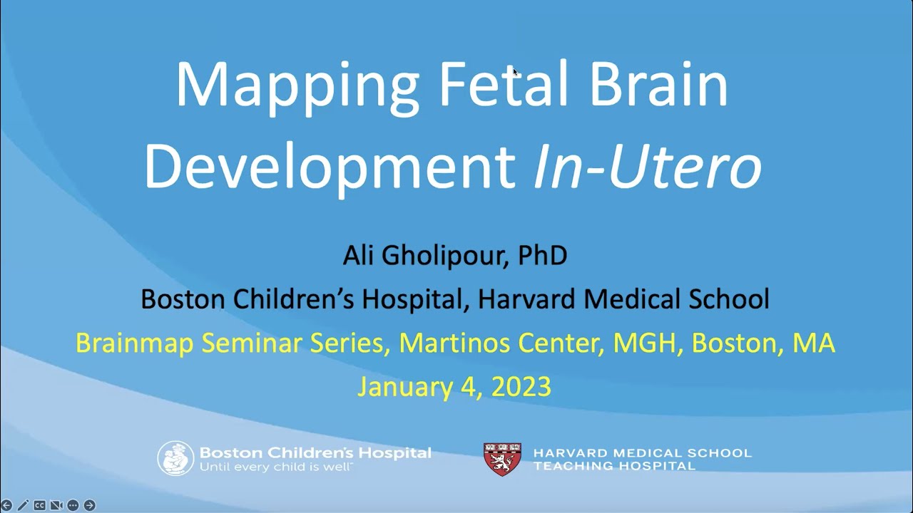BrainMap: Mapping fetal brain development in-utero