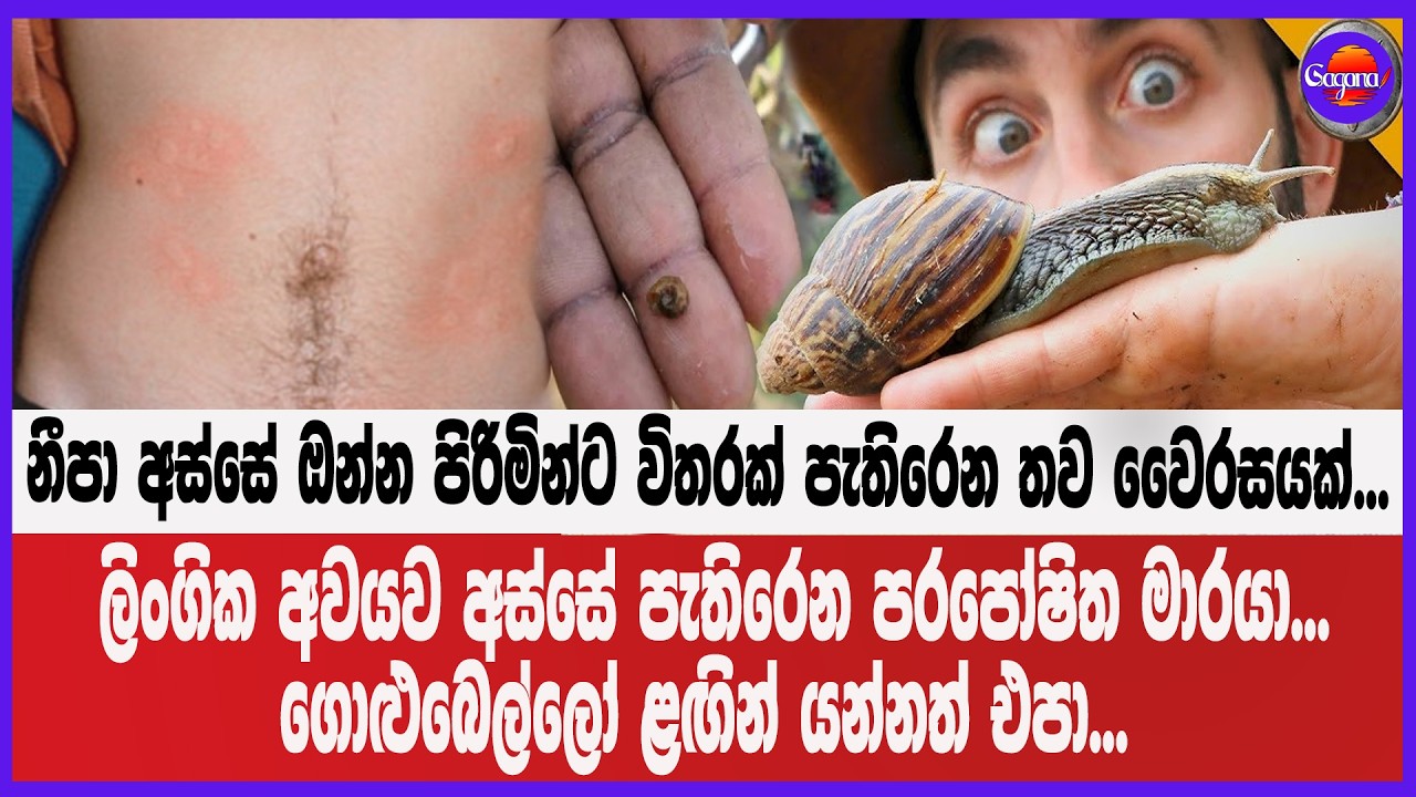 කොල්ලොනේ පරිස්සම් කර ගනිල්ලා...ලිංගික අවයව අස්සේ පැතිරෙන පරපෝෂිත මාරයෙක්...