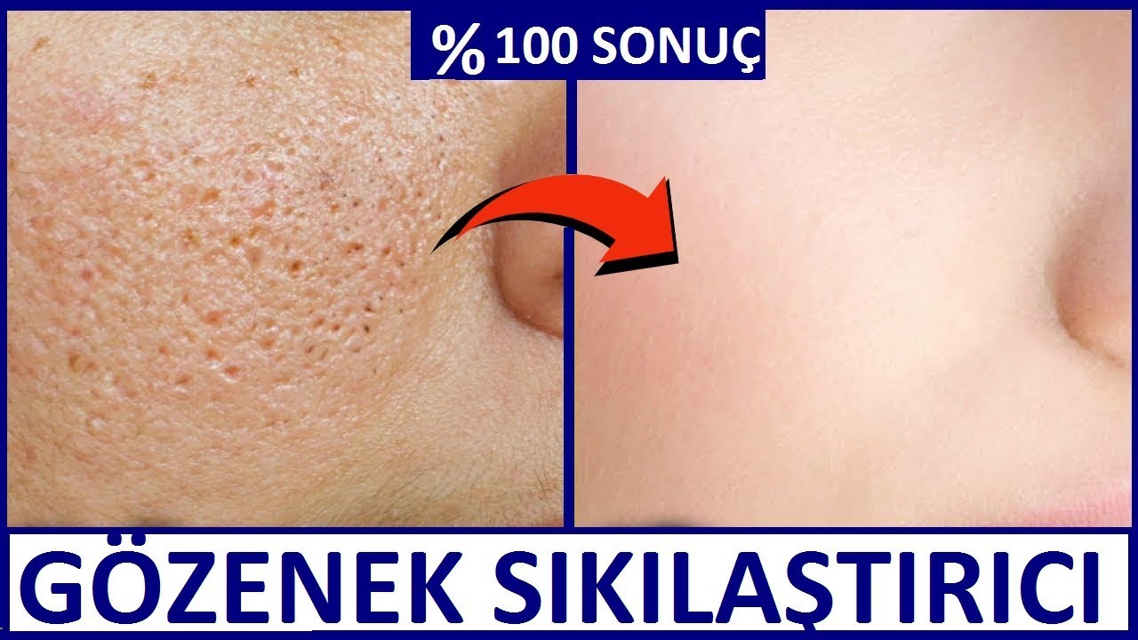 G&Ouml;ZENEK SIKILAŞTIRICI YUMURTA MASKESİ - % 100 SONU&Ccedil; - G&uuml;zellik Bakım