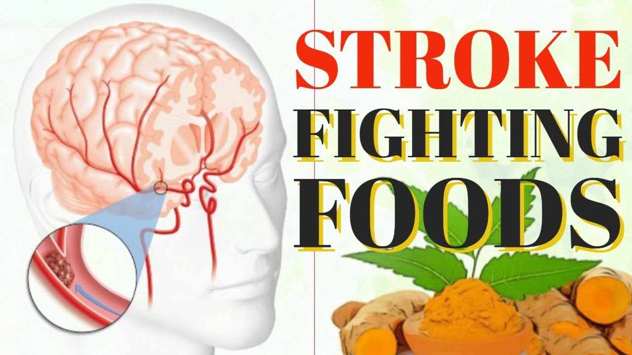 The Best Foods to Lower Your Risk of Stroke