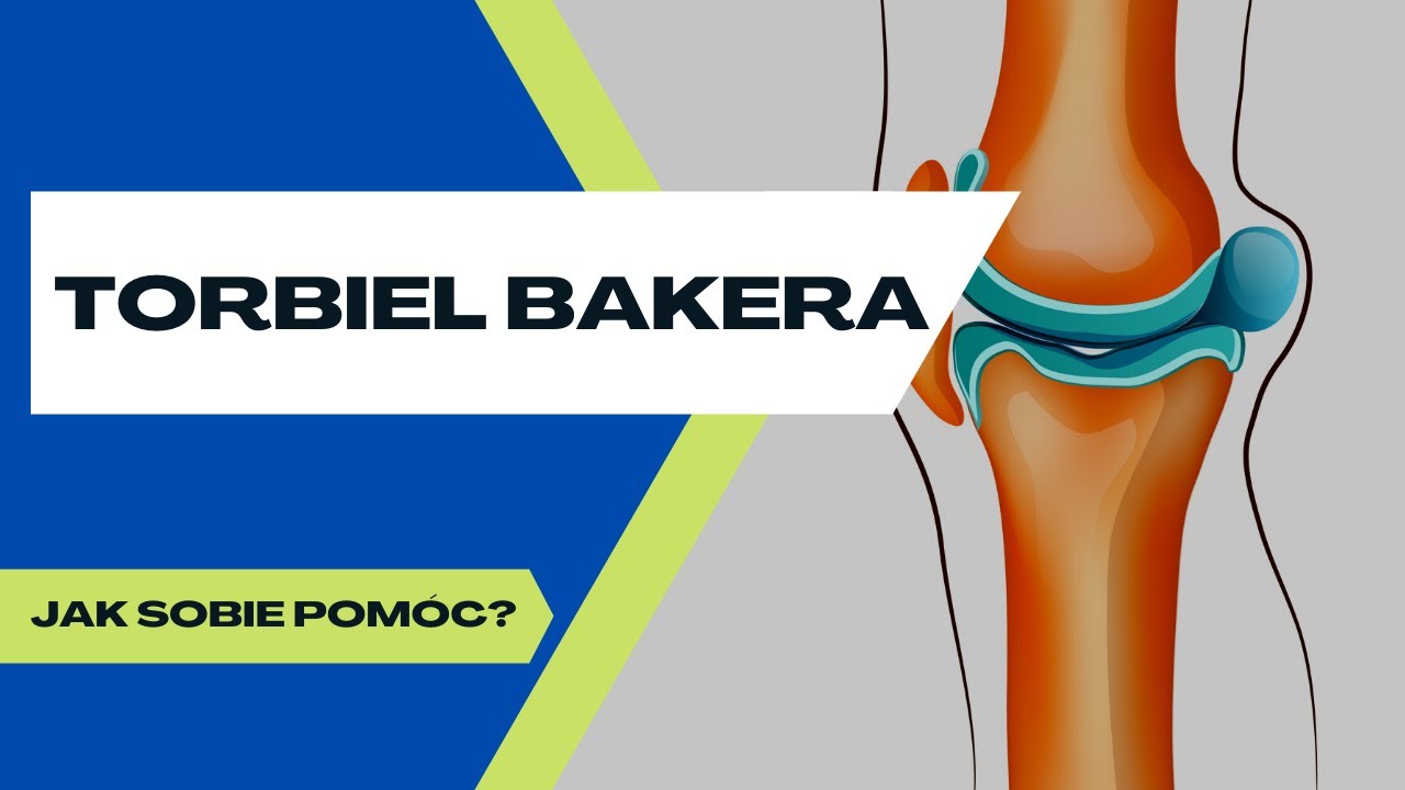 Torbiel BAKERA — proste ćwiczenie