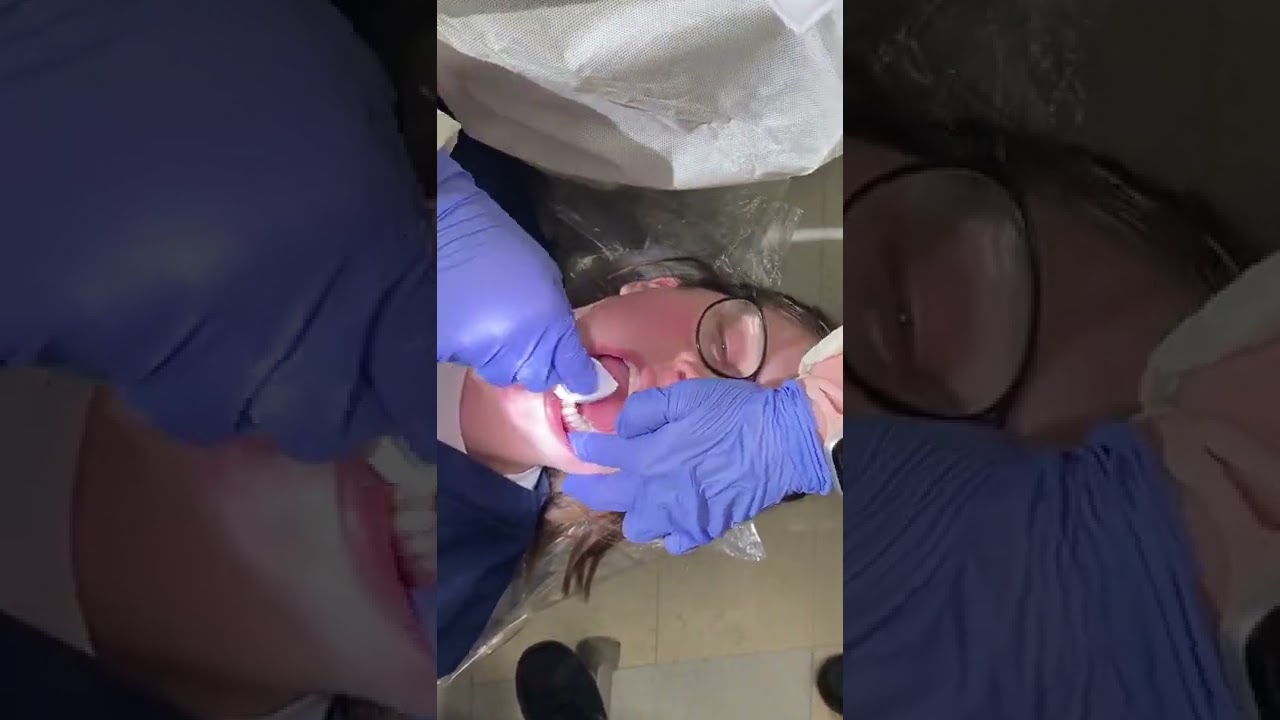 Intraoral Exam #1