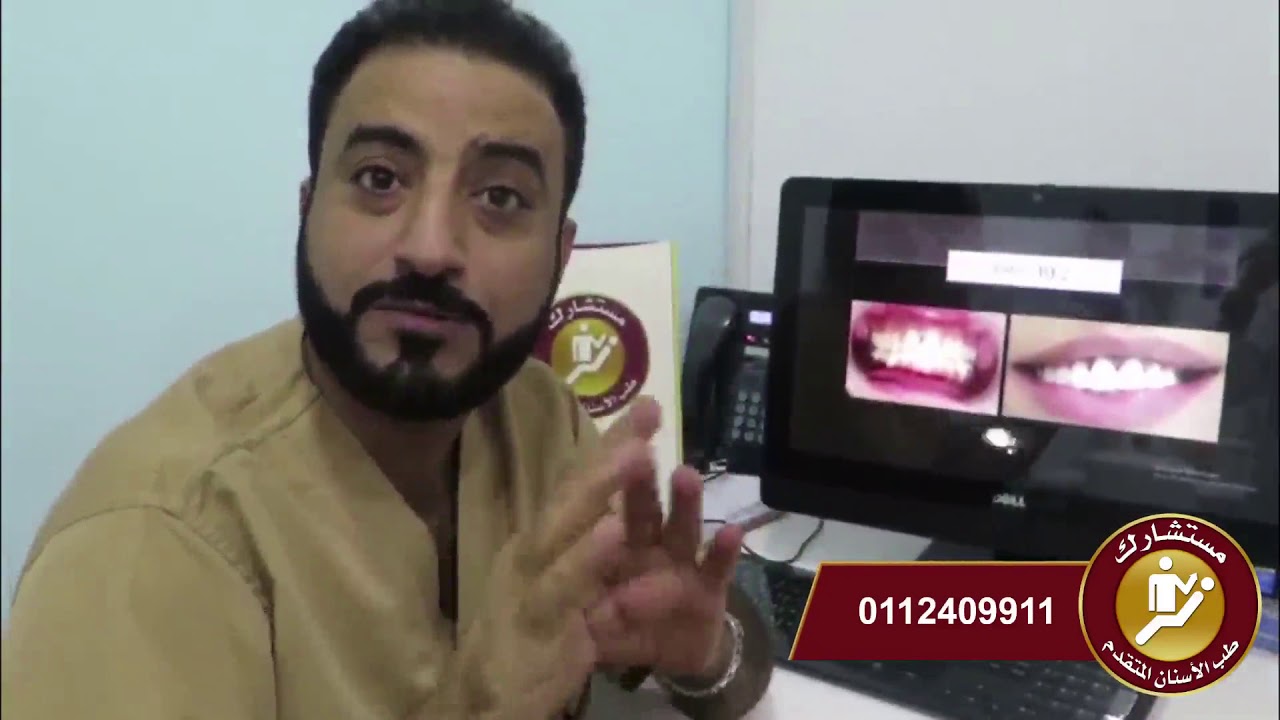حالات تجميل اسنان