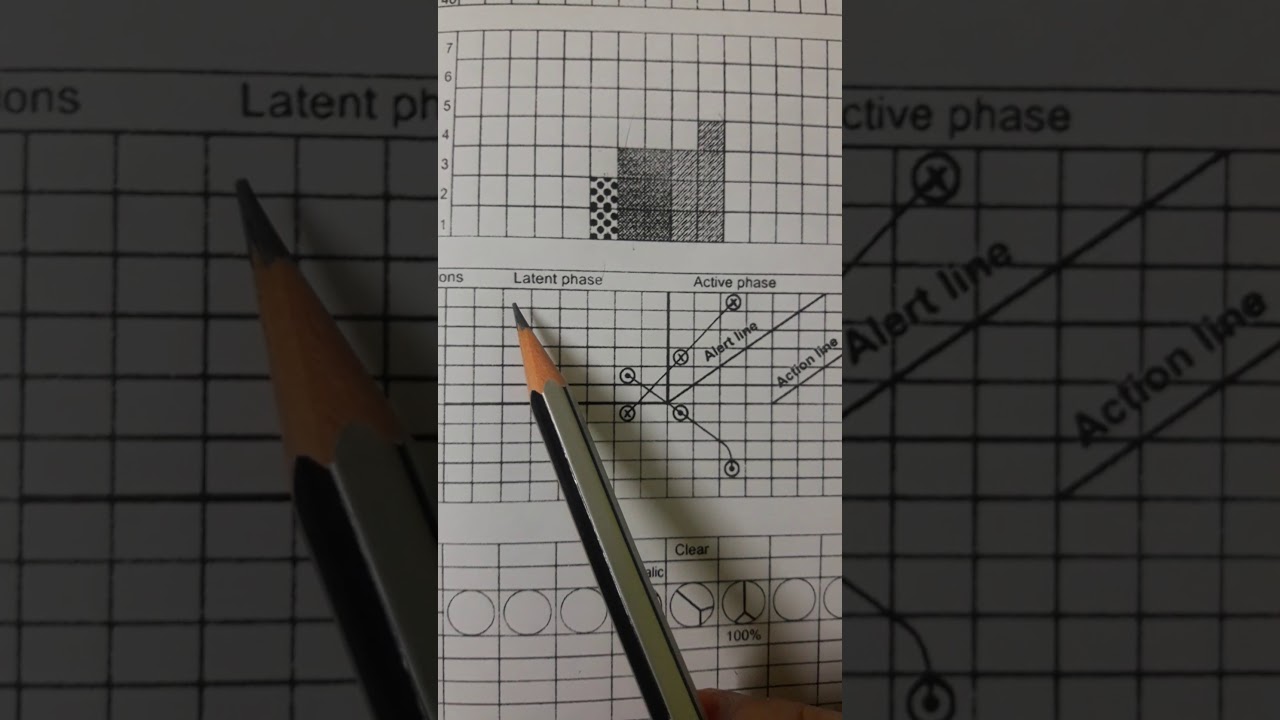 Partograph