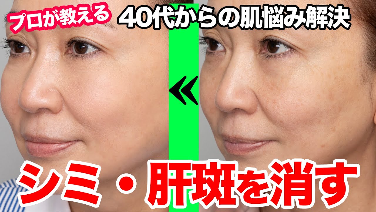 【シミ・肝斑】しっかり隠れて厚ぼったくない！ 悩んでいる人はやってほしい プロが教えるシミ・肝斑を完全に隠すメイク