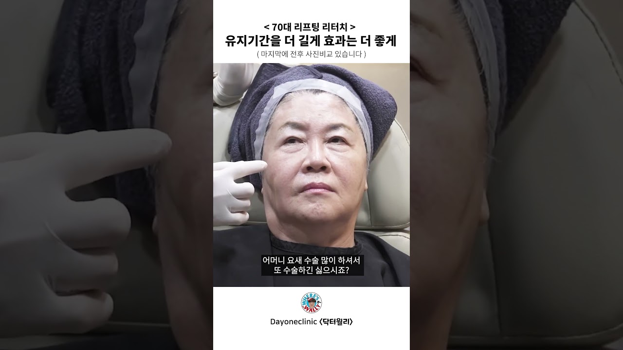 실리프팅 효과를 극대화하려면 리터치가 필요할까? #skincare #리프팅효과 #60대성형