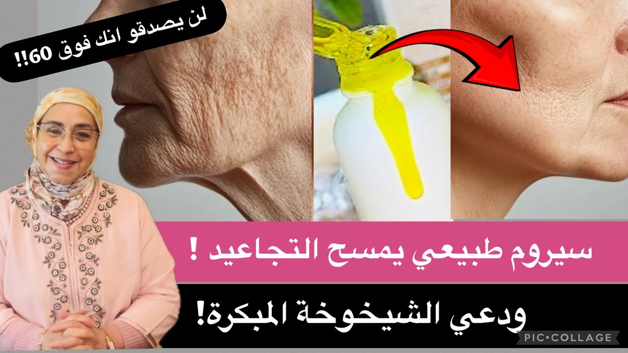 سيروم طبيعي يقضي على التجاعيد والترهلات مهما كان العمر 🔥 نتيجة من أول شهر