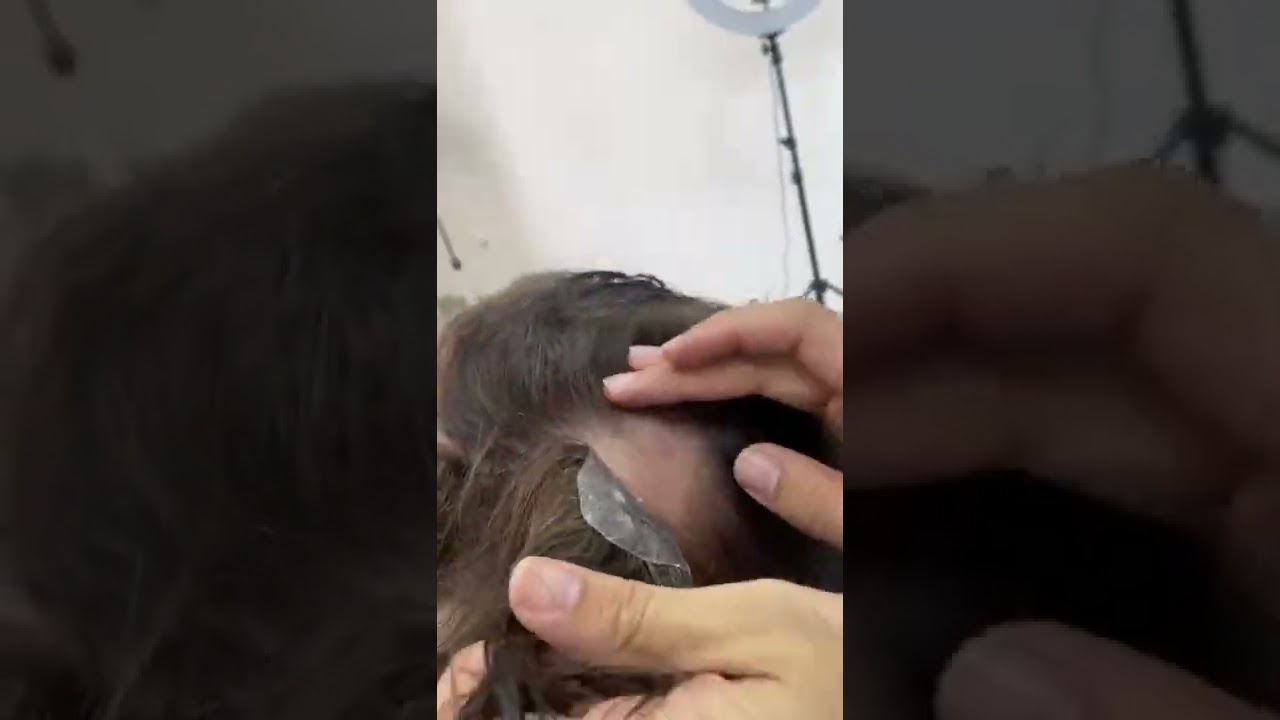 Mini protese capilar