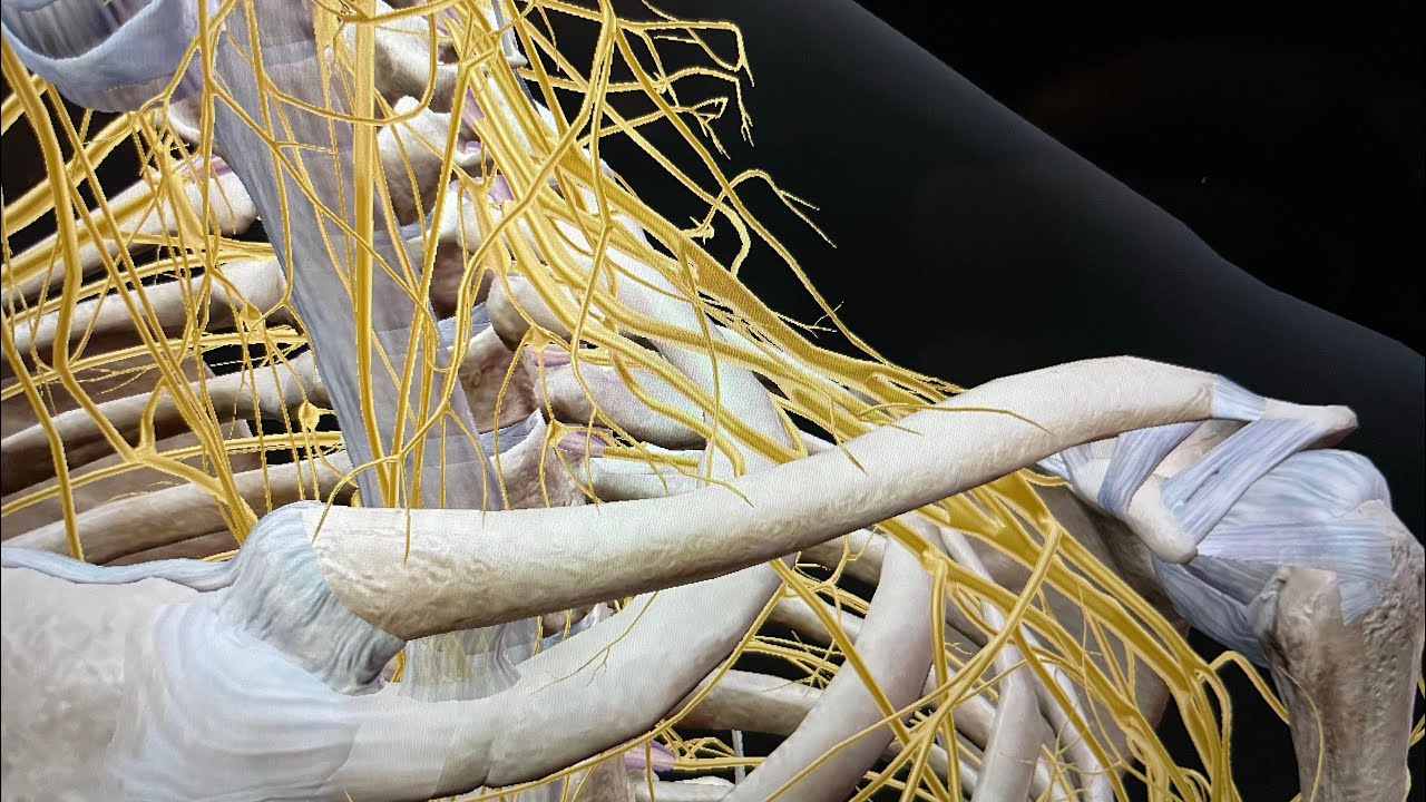Tu as une névralgie cervico-brachiale?