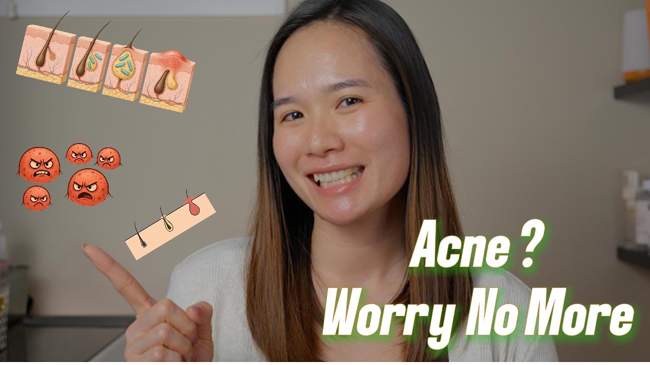 How to Treat and Prevent Acne | Healing Journey Starts Here (Ep. 1)