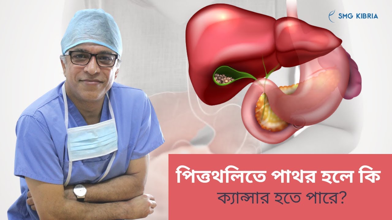 পিত্তথলিতে পাথরের কারন ও প্রতিকার | gallbladder কোথায় থাকে? |  gallstones symptoms
