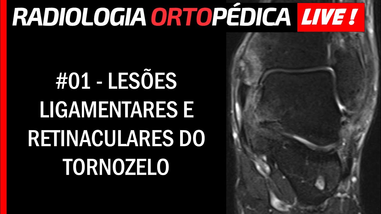 Live! #01 - Lesões Ligamentares e Retinaculares do Tornozelo