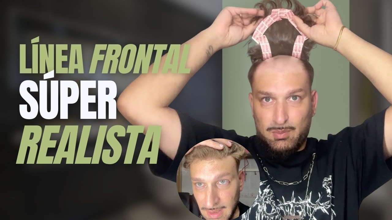 ¿Pelo real o prótesis? El frontal que NADIE nota