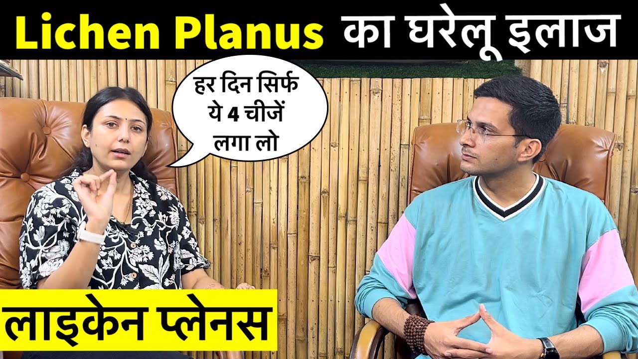 Lichen Planus Treatment Ft. @Upasana Ki Duniya | Skin Disease | Himanshu Bhatt