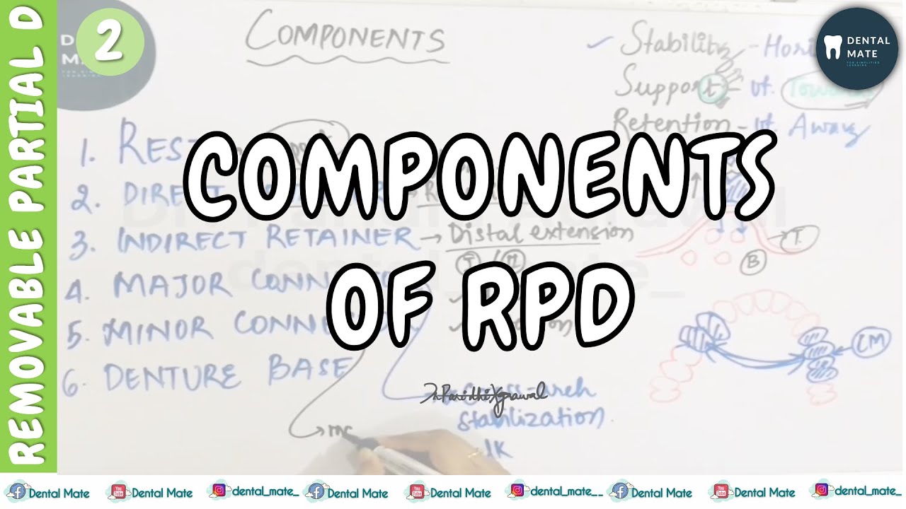 Components of Removable Partial Denture | Retention | Stability | Support | Dr Paridhi Agrawal