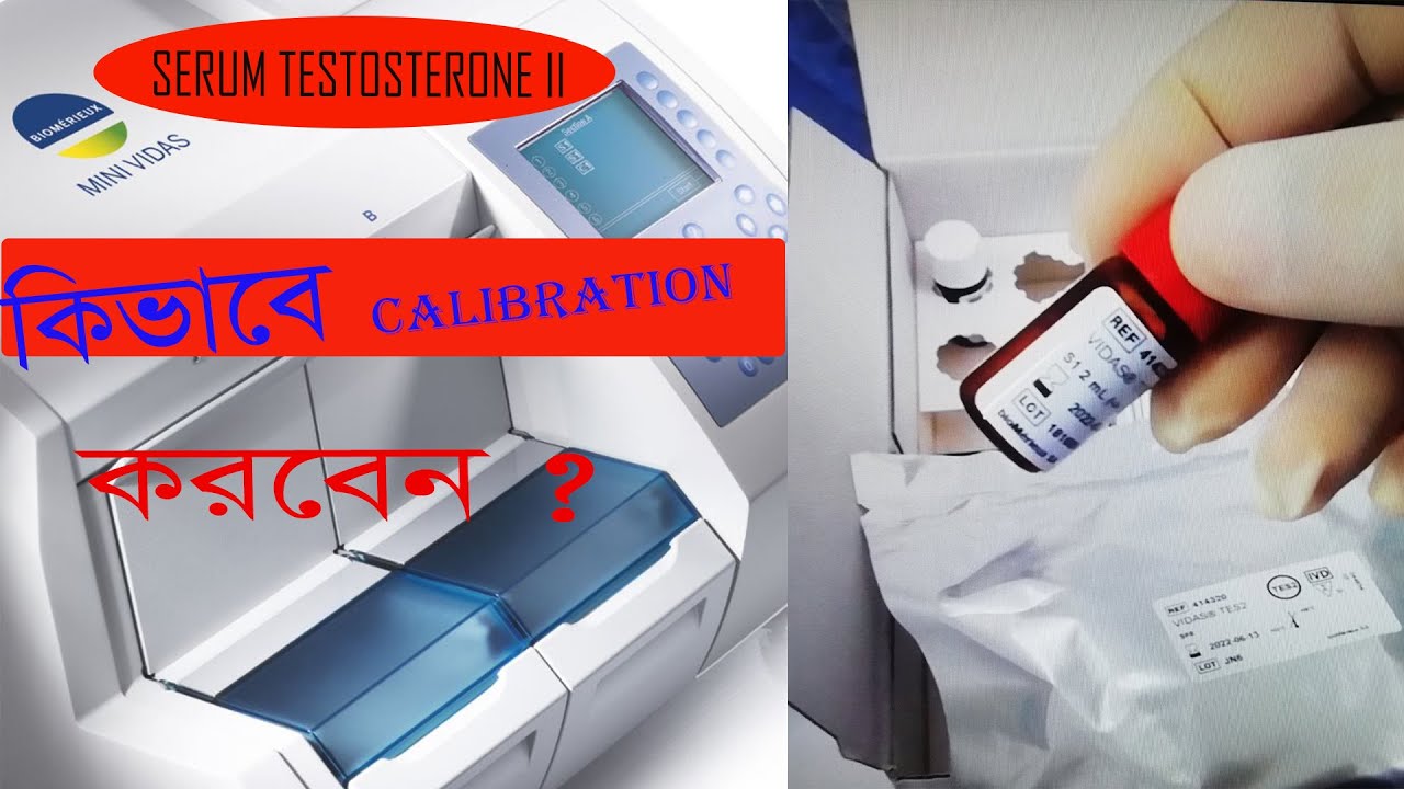 Mini Vidas Serum Testosterone Calibration/ How to Run testosterone Calibration in Mini Vidas ?