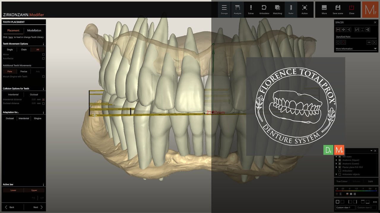 Full denture creation without existing prostheses | Zirkonzahn.Products