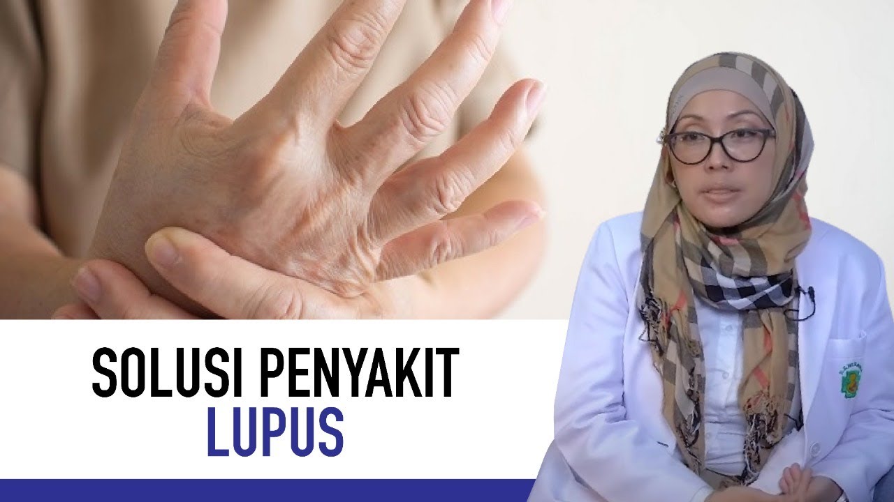 Penyakit Lupus: Penyebab, Gejala dan Cara Mengatasinya | Kata Dokter