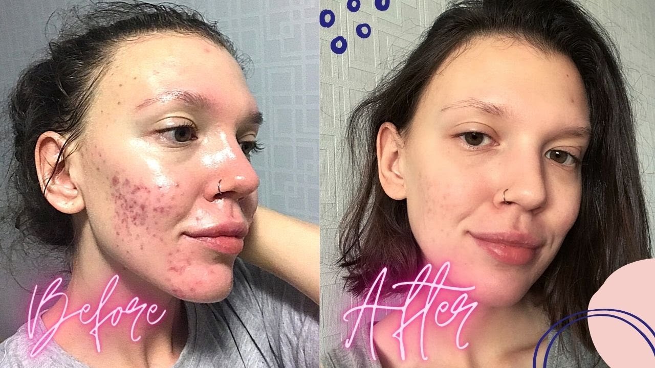 ЗАКОНЧИЛА КУРС СОТРЕТ | КАК ЭТО БЫЛО