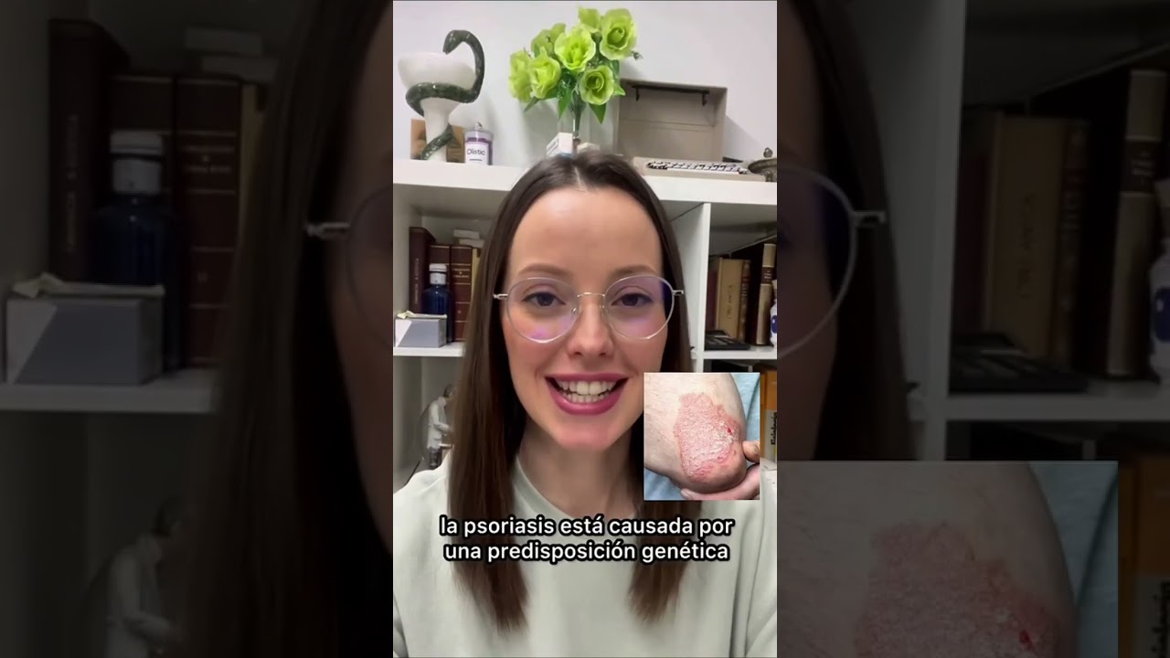 C&oacute;mo saber si tengo Ezcema(Dermatitis) o Psoriasis | Farmacia Gamo