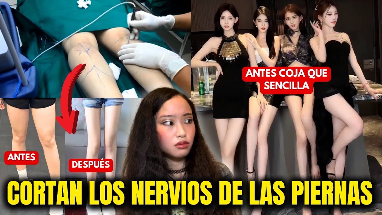 La cirugía que DESTRUYE TUS PIERNAS para que parezcan perfectas: ¡TERMINAN EN SILLAS DE RUEDAS!