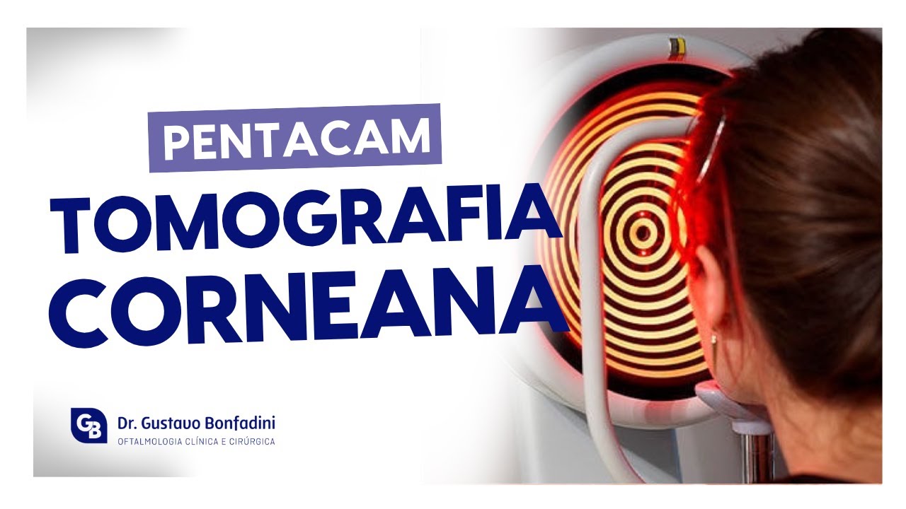 PENTACAM: O QUE É E PARA QUE SERVE A TOMOGRAFIA CORNEANA?