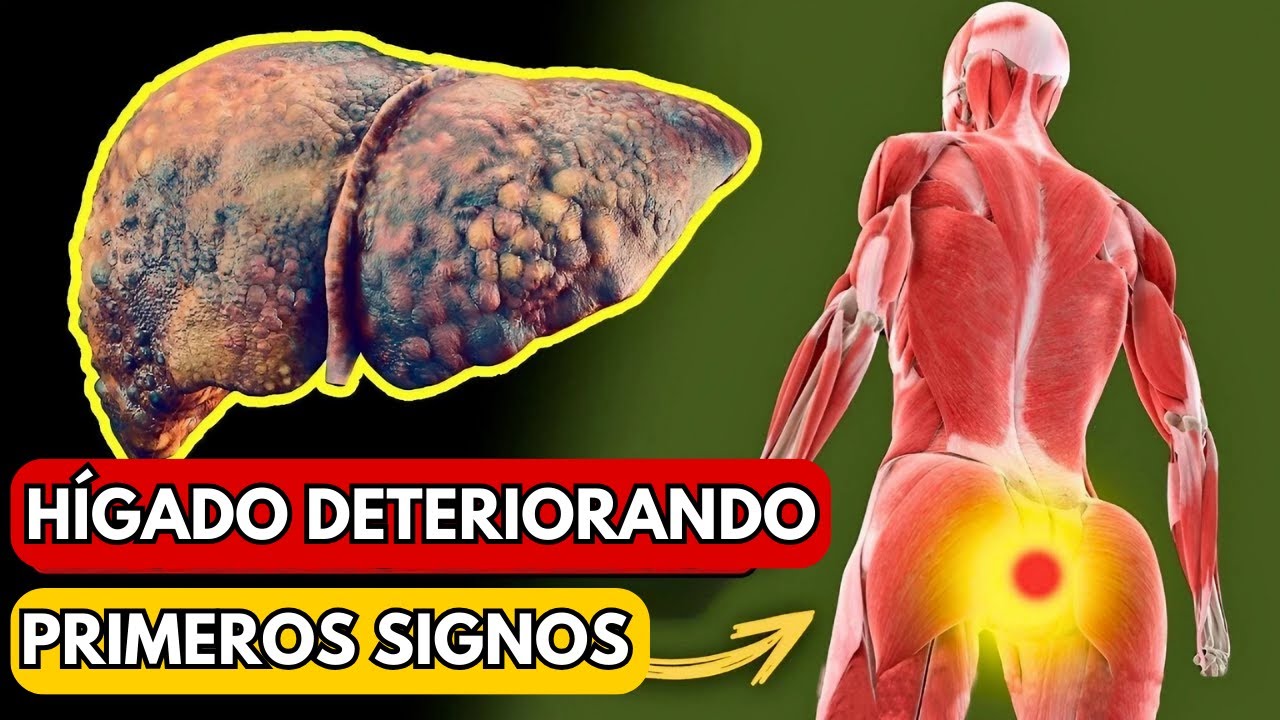 ¡EL HÍGADO SE ESTÁ DETERIORANDO! 12 Signos Extraños de DAÑO HEPÁTICO