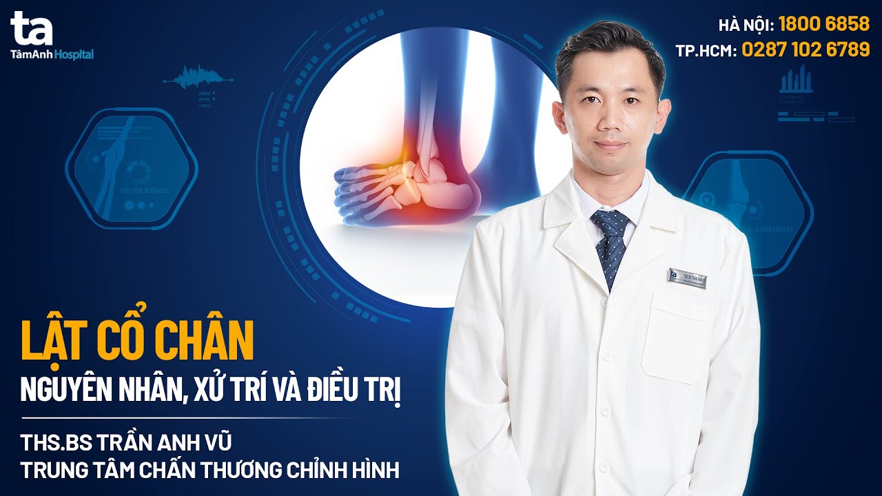 Lật cổ chân: Nguyên nhân, xử trí và điều trị | CTCH Tâm Anh