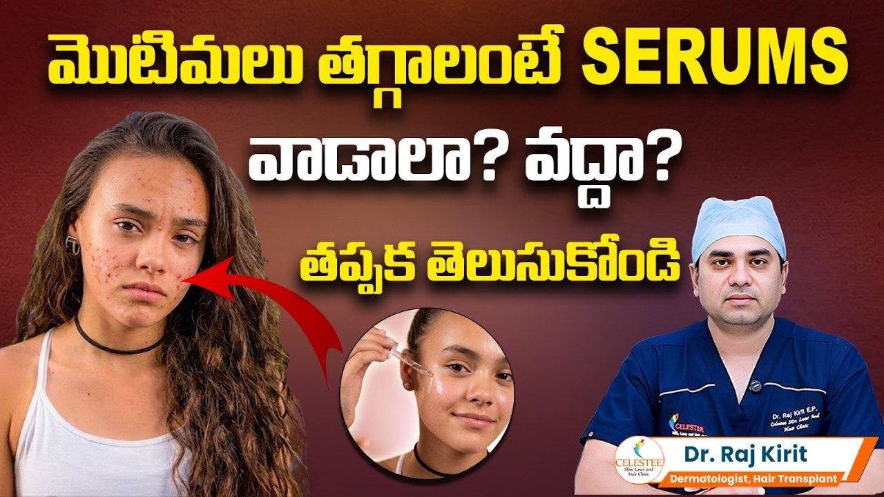 Why do Teenagers Get Pimples? Side Effects of Using Serums on Face | Celestee Skin And Hair Clinic
