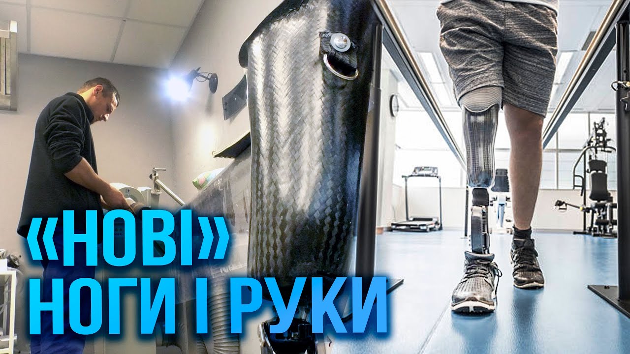 «Сміливий крок»: у Запоріжжі працює Центр протезування