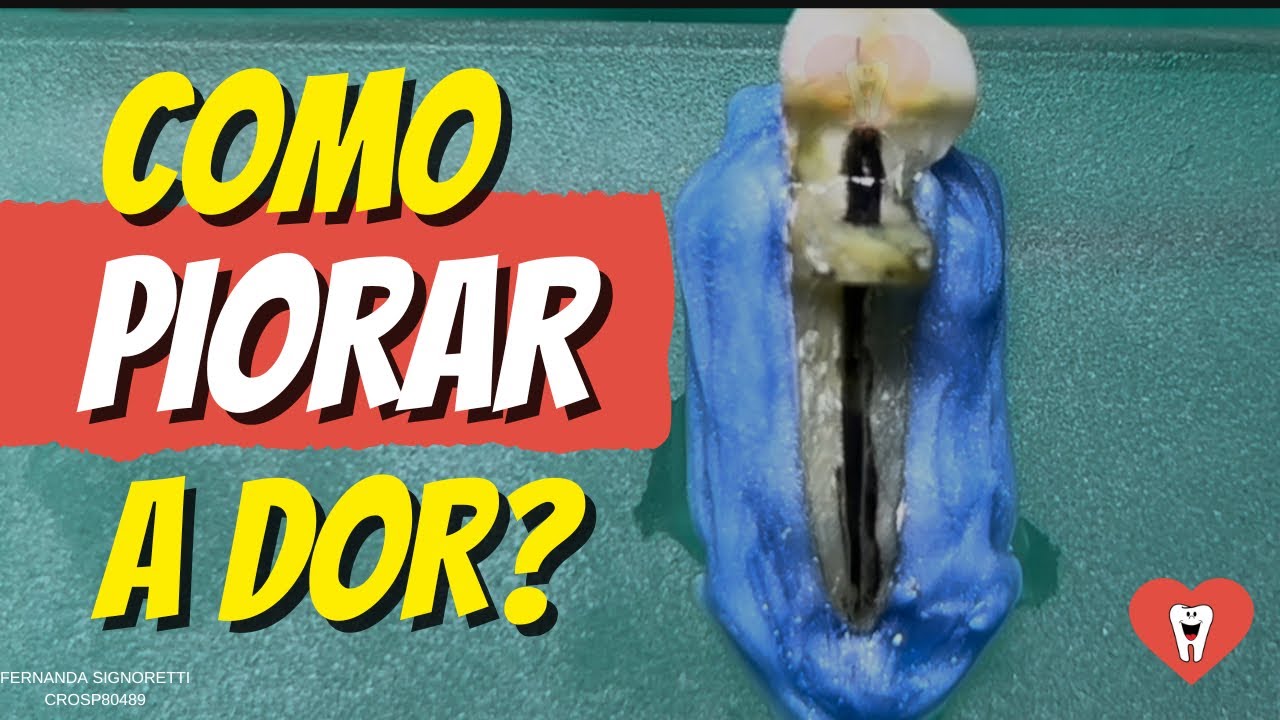 ENDODONTISTA, ASSISTA ATÉ O FINAL SE QUISER EVITAR DOR DE CABEÇA COM ABSCESSOS - Endolovers 