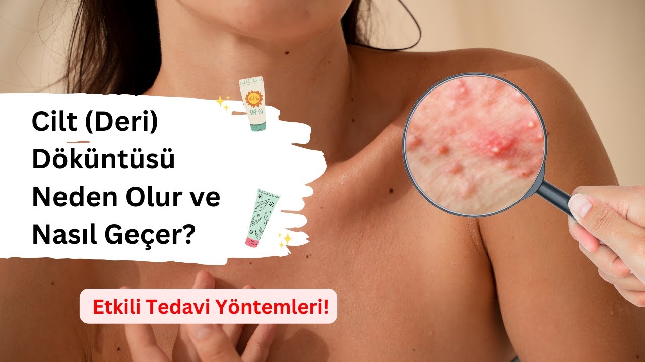 Cilt (Deri) D&ouml;k&uuml;nt&uuml;s&uuml; Neden Olur ve Nasıl Ge&ccedil;er? | Etkili Tedavi Y&ouml;ntemleri!