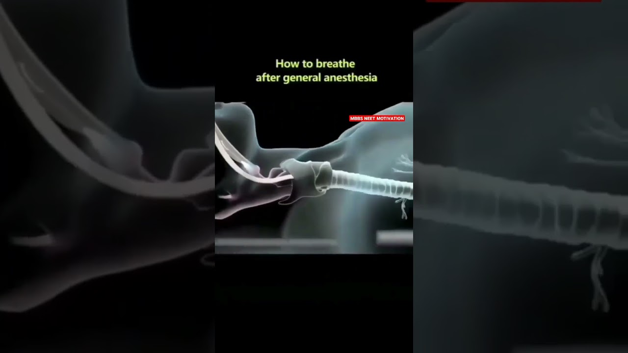 Animation of how to breathe after General anesthesia.          #mbbsvideos #mbbspractical #neet2023