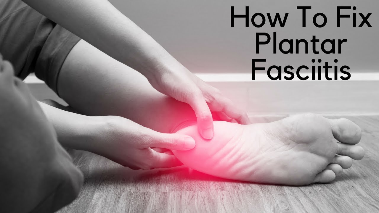 How To Fix Plantar Fasciitis - Chiropractor in Burke, VA
