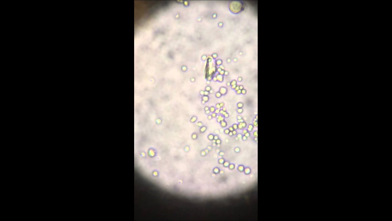 Marine velvet(Amyloodinium ocellatum) in microscope