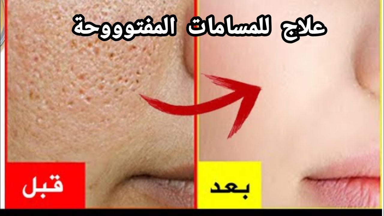 حبسي ما تخسري دراهمك ⛔ فكل منتج يخرج |الفرق في اول شهر 🍀غيري بشرتك للأحسن#اكسبلور #viral #skincare 