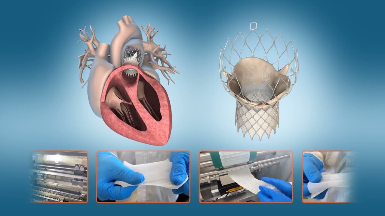 Confluent Medical Textiles Overview