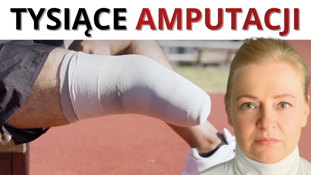 AMPUTACJE co 90 minut. Czy klucz do ratunku mamy we własnej buzi?
