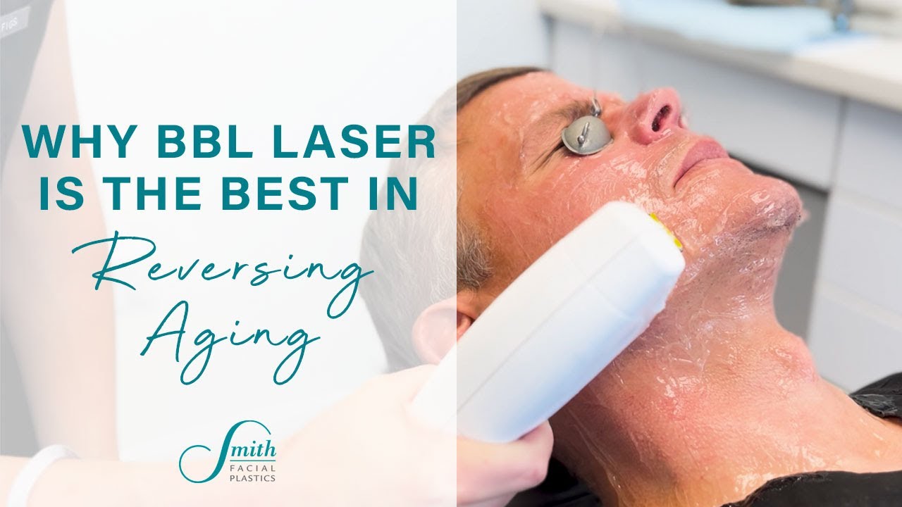 What you really need to know about the BBL Laser | Skin Rejuvenation