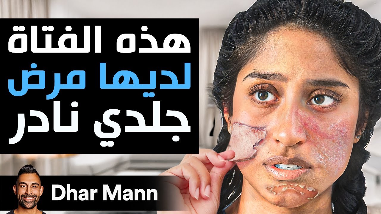 Dhar Mann Studios | هذه الفتاة لديها مرض جلدي